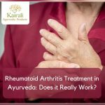 Rheumatoid Arthritis Treatment