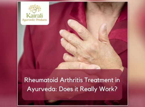 Rheumatoid Arthritis Treatment